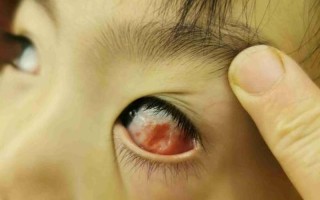 1给小0扩张疼哭了怎么办(小0扩张疼哭不已，1该怎么办？)