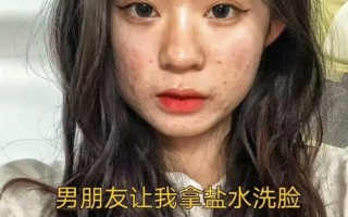 男朋友吃自己的痘痘的感觉—男友痘痘饕餮盛宴：探索自痘自嗨的禁果之旅