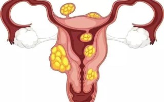 15cm能到子宫吗_15公分能触及子宫吗？解开妇科检查的神秘面纱