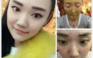 专业祛皱(逆时光奇迹：专业除皱美白，绽放青春焕彩)