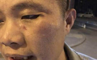 接 *** 被辱骂怎么办(被 *** 折磨得失声的娇柔受)