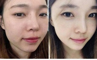 水融：肌肤融合术，重焕水盈光泽