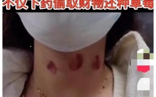 唇印先于爱恋初绽