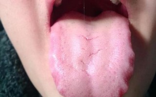 有什么东西像舌头一样—舌感奇遇：家中的秘密舌苔”