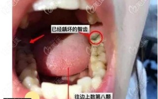 又大又粗又硬拔不出来_难以拔除的庞然巨物，卡住难解之困