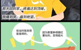 男生一定要割吗？_男生割皮：必做还是可免的争议