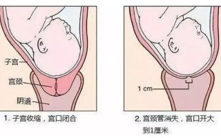 生孩子宫口在什么位置图片—剖宫产直击视角：见证胎儿的诞生